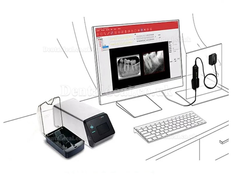 Handy HDS-500 PSP Scanner Dental Phosphor Plate Scanner